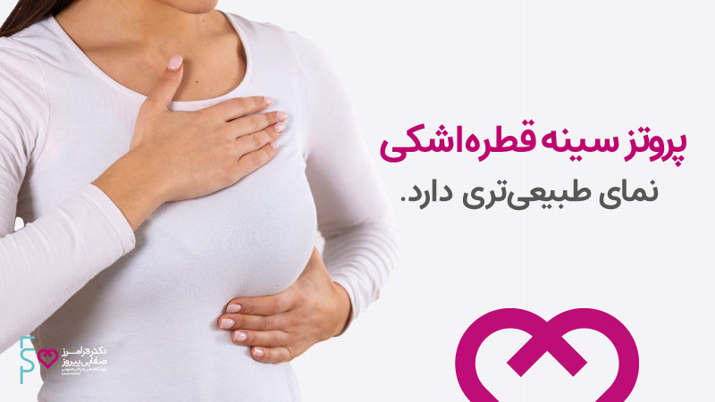 انواع ایمپلنت سینه | پروتز سینه قطره اشکی